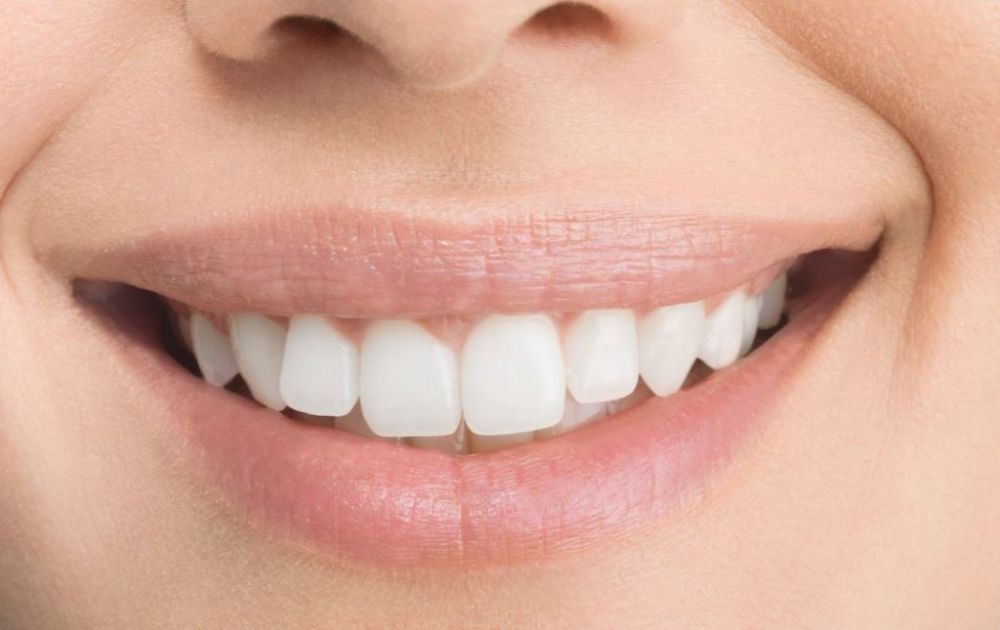 10 hal kesehatan gigi